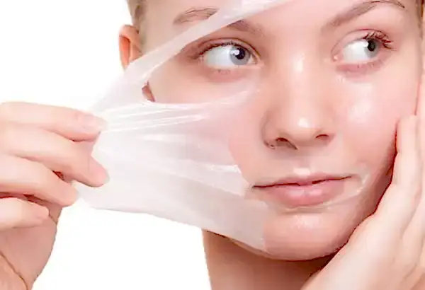 Peeling Nedir?