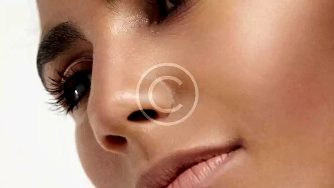 Dudak B.Toksin Uygulamaları