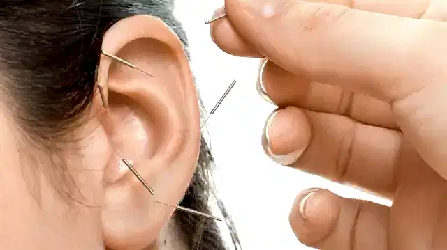 Akupunktur Panik Atak Tedavisi