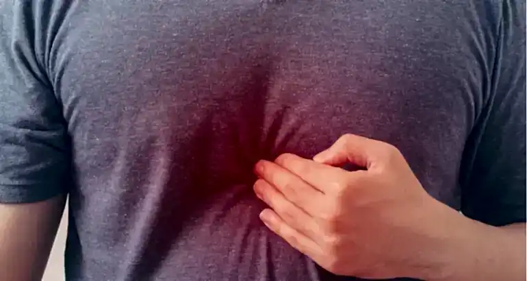 Akupunktur Reflü Tedavisi