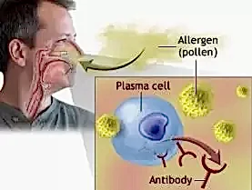 Akupunktur İle Alerjik Rinit Tedavisi