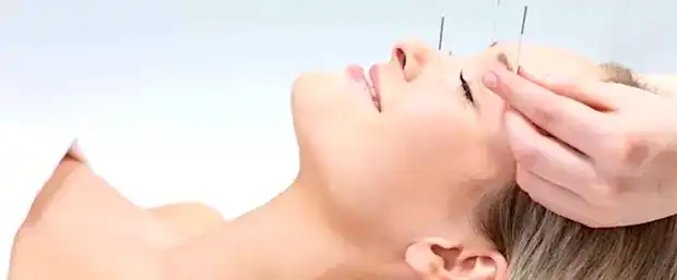 Akupunktur ile Depresyon Tedavisi