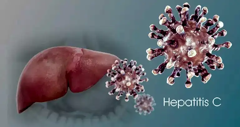Ozon ile Hepatit Hastalığı Tedavisi