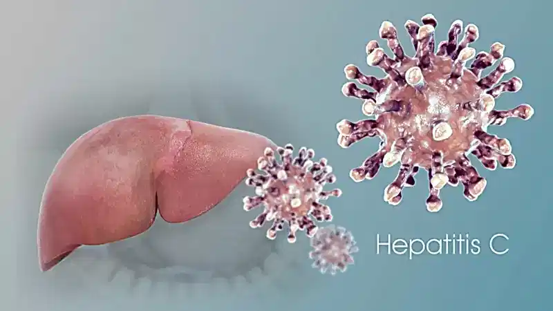 Ozon ile Hepatit Hastalığı Tedavisi
