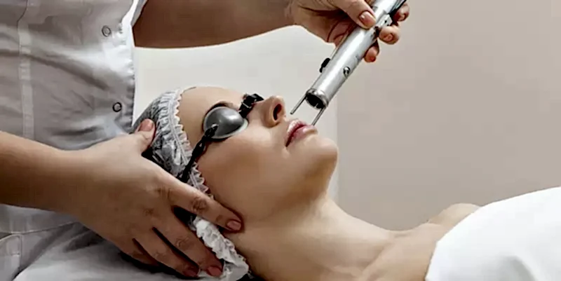 Leke Tedavisinde Lazer