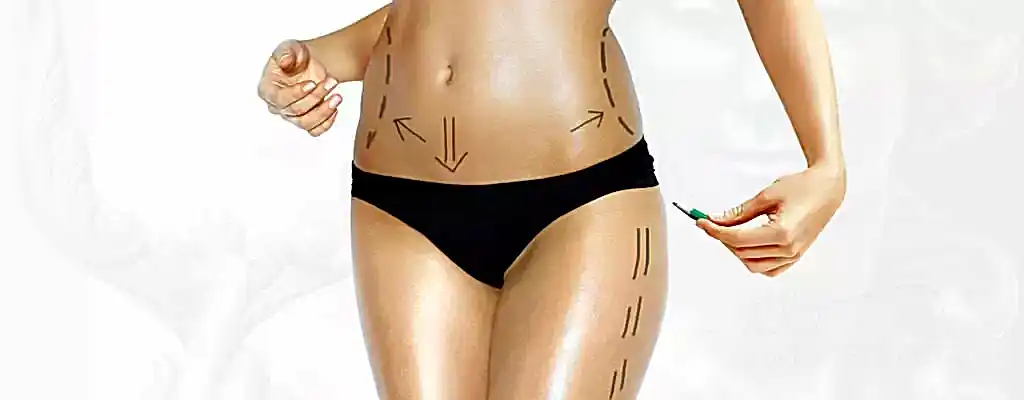 Mezoterapi İle Lipoliz (Yağ Eritme)