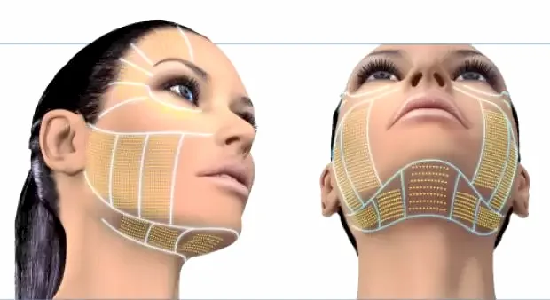 Örümcek Ağı Estetiği Nedir?