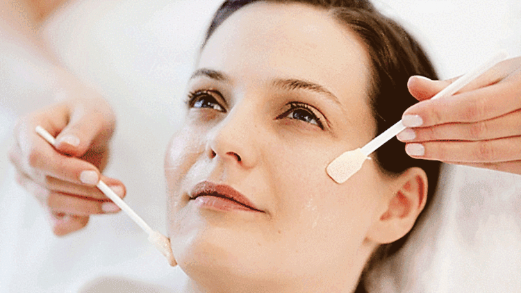 Kimler Peeling Yaptırabilir?