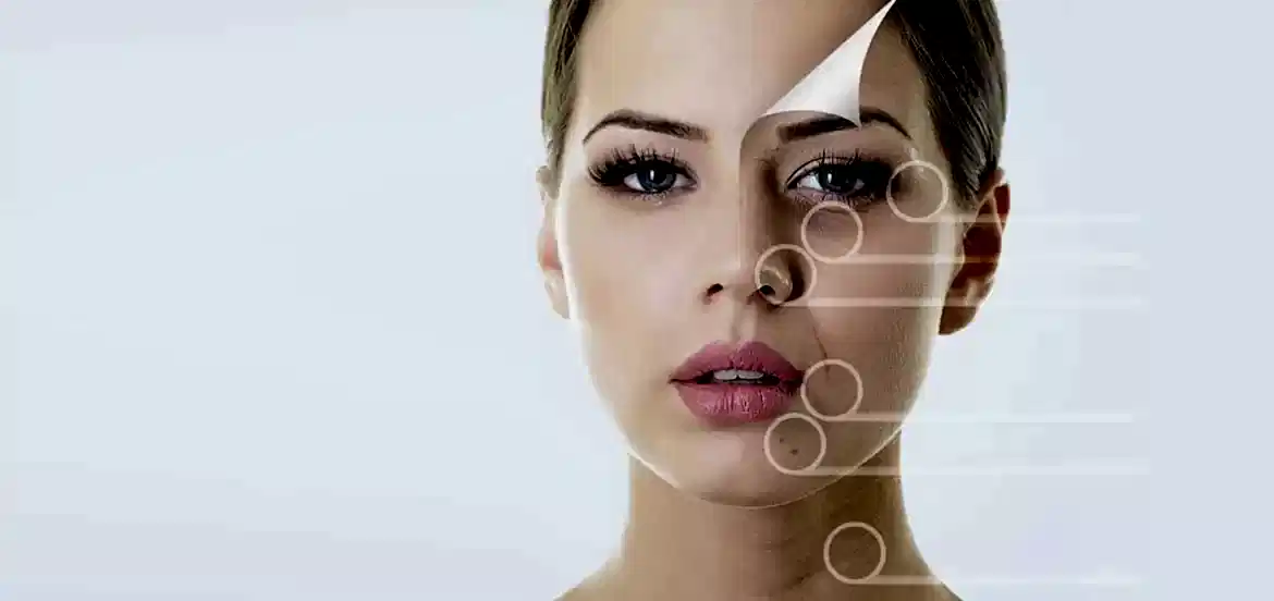 Cilt Gençleştirmede RF (Altın İğne)