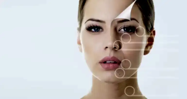 Cilt Gençleştirmede RF (Altın İğne)