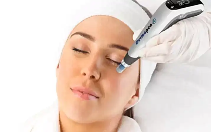 Cilt Gençleştirmede Mikroneedling (Dermapen)