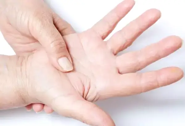 El Terlemesi Nedir ?