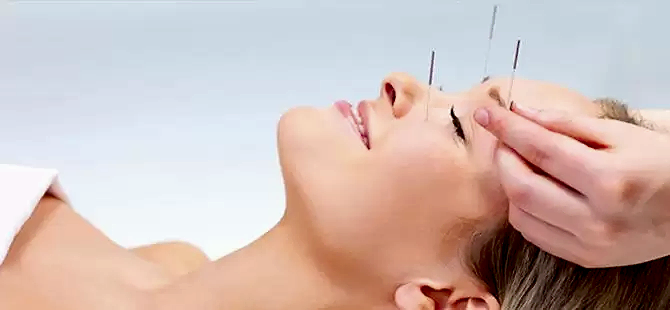 Kozmetik Akupunktur Nerelerde Kullanılır?