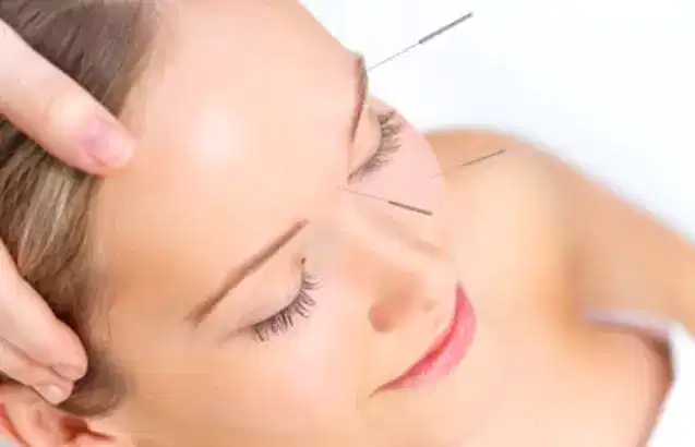 Kozmetik Akupunktur Etki Mekanizması