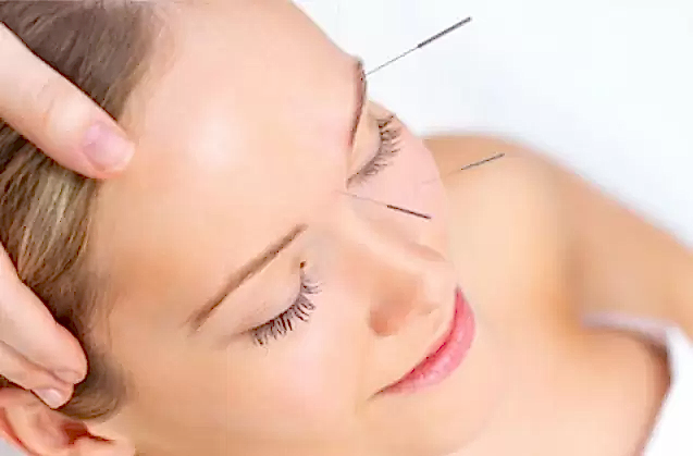 Kozmetik Akupunktur Etki Mekanizması