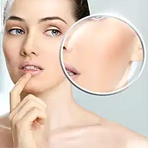 Plexr İle Ben Aldırma Tedavisi