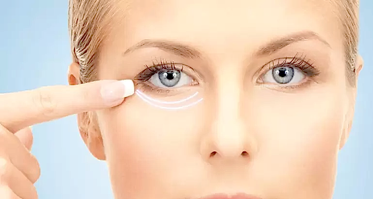 Işık (Göz Altı) Dolgusu